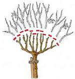 cięcie piennej kopułowej